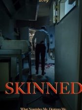 Skinned 